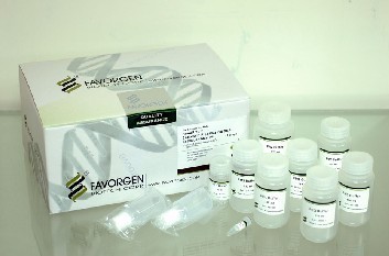 人類白細(xì)胞抗原GElisa試劑盒,HLA-G試劑盒_上海雅吉生物科技_PCR檢測(cè)試劑盒_生物制劑_生物試劑 _阿儀網(wǎng)